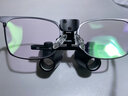 SeeClear高倍2.5倍3倍3.5倍头戴式眼镜式医用手术放大镜高清牙科外科骨科眼科耳鼻喉科整形 眼镜式2.5倍420mm放大镜 实拍图