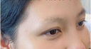 璀璨洗眉机黑科技祛斑美白仪器大功率无痛皮秒洗纹身机美容院用 2024新款不加水璀璨五头 实拍图