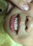 贝斯尼儿童牙齿矫正夜间保持器牙套男女通用硅胶防磨纠正龅牙地包天反颔 二阶段（儿童款 实拍图