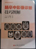 脑卒中影像诊断技巧图解 影像诊断 读片技巧 影像解剖 北京科学技术 实拍图
