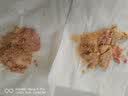 史达德（STADA）德国进口Oralpaedon补液盐婴儿电解质水补水冲剂宝宝儿童成人腹泻 102.6g*2盒 草莓味 10袋/盒*2盒装 实拍图