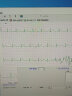 力康（Heal Force）心电仪24小时连续监测心电图波形便携医用家用手持心脏监护仪心率检测 180B蓝牙版送100片电极片（7仓速发） 实拍图