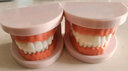 伯元堂【口腔教学】牙齿模型幼儿早教刷牙幼儿园教刷牙儿童宝宝口腔教学  (蛀牙与正常)1:1套装共2个 实拍图