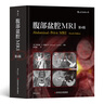 腹部盆腔MRI（第4版）京东超级618 实拍图