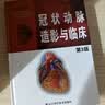 冠状动脉造影与临床（第3版） 实拍图