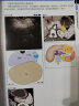 胆胰EUS 超声内镜检查术 内镜超声术 辽宁科学技术出版社 图书 晒单实拍图