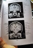 正版现货 医学影像学解剖图谱丛书 共4本 正常关节磁共振解剖图谱+神经影像解剖图谱+胸部影像解剖图谱 晒单实拍图