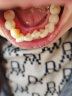胖猫德国洗牙器超声波洁牙器便携式去烟渍牙结石去除器牙齿清洁家用洗牙神器可视口腔清理牙垢黑黄牙渍 魔力白丨灯+罩+镜+墙架+洁牙8件套丨配 4支喷头 实拍图