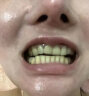 海依高牙齿矫正器隐形牙套成人牙套矫正隐形牙套保持器防磨牙牙不齐地包天 上牙或下牙单排 6个 实拍图