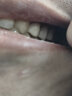全瓷牙冠威兰德二氧化锆爱尔创泽康3m拉瓦全瓷牙根管治疗镶牙补牙义齿假牙齿贴面片全瓷牙套二氧化锆烤瓷牙 泽康全瓷牙 晒单实拍图