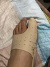 足峰脚趾矫正器拇指外翻矫正器大脚骨纠正器日夜用拇外翻矫形器可穿鞋 肤色左脚（1只） XL（40-45码适用） 实拍图
