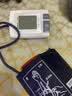 九安（Andon）电子血压计 家用上臂式血压测量仪 老人智能血压仪医用高精准测量 【医用级别】语音播报+智能提醒+夹子袖带 实拍图