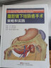 腹腔镜下结肠癌手术策略和实践 实拍图