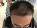 MARASIL 玛瑞莎激光健发仪器LLLT电光健发梳健发梳美容仪头皮按摩护理ji活毛发进生长fang秃护发礼物 白色 实拍图