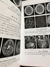 神经系统疾病影像诊断与分析 实拍图