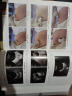 临床常见疾病超声图谱系列--妇科超声诊断临床图解 实拍图