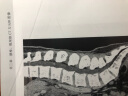 脊柱与四肢影像解剖图谱 实拍图