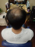 鼎盛摩尔金鼎盛摩尔 假发男发际线男士假发片补头顶隐形秃顶中分无痕补发 定制补发意向金 短发 实拍图