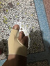 蓓戈 大拇指外翻脚趾矫正器纠正器矫正带袜套拇外翻大脚骨大脚趾头脚指矫正器分趾器成人男女可穿鞋 拇指外翻矫正器肤色 M码（适合30-39码） 实拍图