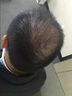 MARASIL 玛瑞莎激光健发仪器LLLT电光健发梳健发梳美容仪头皮按摩护理ji活毛发进生长fang秃护发礼物 白色 实拍图