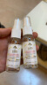 艾诗可因 冻干粉修复肽28ml  激光美容后护理敏感肌肤护理 保湿修护精华液 实拍图