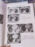 医学影像学读片诊断图谱：胸部分册 晒单实拍图