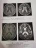 影像鉴别诊断一目了然系列--MRI鉴别诊断一点通（第三版） 实拍图