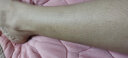 修益舒鸡皮肤疙瘩毛囊角化去除手臂胳膊上腿上的小疙瘩大腿毛周角化症膏 5盒装 实拍图