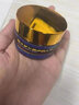 洛神医鱼鳞病专用的药鱼鳞皮肤霜去鱼鳞蛇皮病干燥脱皮鸡皮肤进口身体乳 特效：买2送1【疗程】重度鱼鳞皮 实拍图