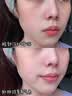 芮思琳科技美容仪V脸紧致提拉红光蓝光彩光嫩肤亮肤仪微电流超声波深层清洁平滑肌肤收毛孔520送礼 专业pro版 实拍图