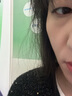 [达霏欣]米诺地尔搽剂 2%*60ml 6瓶装 男女脱发秃发斑秃掉发拯救发际线生发液酊防脱密发 巩固装咨询领券优惠 实拍图