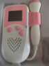 邦力健 胎心仪 医用家用孕妇听胎心监测仪监护仪器胎音仪 数字曲线双显示款 实拍图