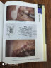 腹腔镜结直肠手术图谱 实拍图