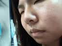 精灵栖木寡肽冻干粉修复红血丝点斑痣后泛红修护敏肌增厚角质维稳多肽舒缓 多肽修护舒缓冻干粉 1盒（5支5ml+5支200mg） 实拍图