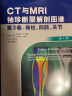 CT与MRI袖珍断层解剖图谱，第3卷：脊柱、四肢、关节 实拍图