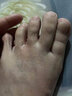 [嘉效]醋酸曲安奈德益康唑乳膏 去脚气药止痒脱皮烂脚丫真菌感染药膏根痒治脚臭脚气专用药(发货特效) 20g 3盒装 【中度脚气瘙痒脱皮【视觉特效】 实拍图