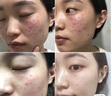 美白祛斑精华液化妆品护肤品补水保湿提亮肤色 1盒14瓶 实拍图