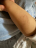 美德玛MEDERMA儿童专用祛 疤膏20g 烫伤摔伤碰撞伤蚊虫叮咬 温和淡疤痕修护凝胶 德国进口 实拍图