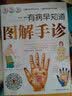 有病早知道：图解手诊 零基础学手诊手诊中医入门零基础学中医诊断中医书籍大全医书籍大全中医中医基础理论 实拍图
