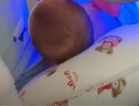 互爱黄疸蓝光灯用新生儿蓝光箱租赁家用照蓝光黄疸蓝光机防护尿裤 护理包 1 实拍图