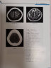 正版 人体断层解剖学图谱(精) CT人体断层局部解剖影像学 人体解剖学断面解剖学图谱 刘树伟主编 山 实拍图