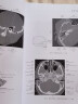 断层影像解剖学(第3版) 实拍图