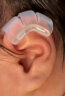 REDERLOE耳朵矫正器硅胶耳夹婴儿固定贴新生儿招风耳耳廓矫正器宝宝垂耳 【院线款】耳夹（单耳）送固定贴 晒单实拍图