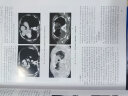 肺部疾病临床与影像解析 实拍图
