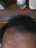 效期至2024年11月）蔓迪 米诺地尔酊90ml 5%浓度生发男女脱发斑秃刺激毛发生长蔓迪喷雾 1盒装【90ml*1瓶】 实拍图