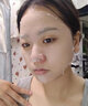 瑞美创瑞美创面部护理精华贴青春痘粉刺修护面膜调理肌肤修复皮肤屏障 面膜*(1盒装) 实拍图