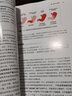 早期胃癌内镜诊断的方法与策略 实拍图