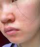 精灵栖木寡肽冻干粉修复红血丝点斑痣后泛红修护敏肌增厚角质维稳多肽舒缓 多肽修护舒缓冻干粉 1盒（5支5ml+5支200mg） 实拍图