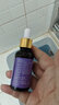 泉婴爱ANUK泉婴爱婴儿多效紫草油盛合抑菌护肤油紫草型 实拍图