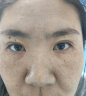 H18日本蛇毒眼膜淡化细纹提拉紧致眼袋贴黑眼圈严重男女士抗皱眼贴膜 晒单实拍图